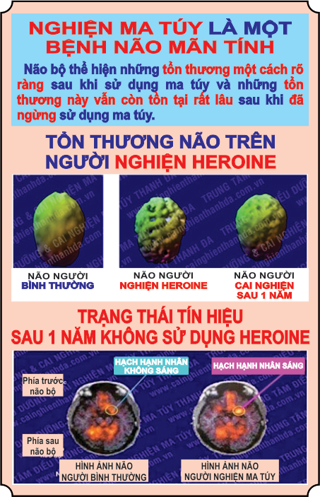 Tổng quan phương pháp phòng chống tái nghiện