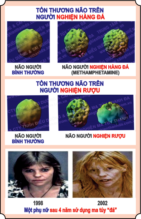 Tổng quan phương pháp phòng chống tái nghiện