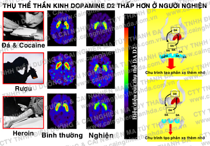 Thụ thể thần kinh Dopamine D2 thấp hơn ở người nghiện
